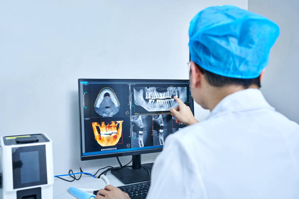Best Knocked-Out Tooth (Avulsed Tooth) Treatment in Chula Vista, TX